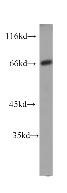 human stomach tissue were subjected to SDS PAGE followed by western blot with Catalog No:107332(NEFL antibody) at dilution of 1:1000