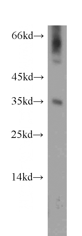 mouse liver tissue were subjected to SDS PAGE followed by western blot with Catalog No:110053(DOK5 antibody) at dilution of 1:300
