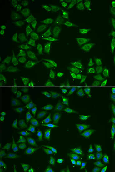 Immunofluorescence - ST3GAL4 Polyclonal Antibody 