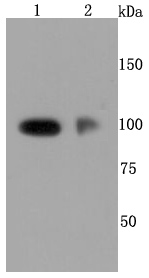 Fig1: Western blot analysis of CD62P on different cells lysates using anti-CD62P antibody at 1/500 dilution.; Positive control:; Line1: HUVEC; Line2: Human placenta