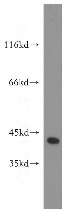 mouse lung tissue were subjected to SDS PAGE followed by western blot with Catalog No:117040(ZFP36 antibody) at dilution of 1:300