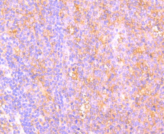 Fig3: Immunohistochemical analysis of paraffin-embedded human spleen tissue using anti-C14orf93 antibody. Counter stained with hematoxylin.