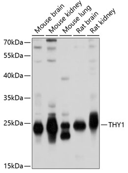 Western blot - THY1 Polyclonal Antibody 