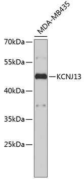 Western blot - KCNJ13 Polyclonal Antibody 