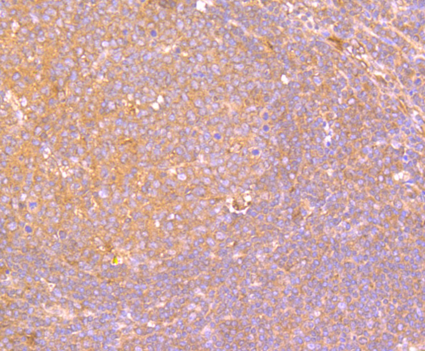 Fig4: Immunohistochemical analysis of paraffin-embedded human tonsil tissue using anti-IL19 antibody. Counter stained with hematoxylin.