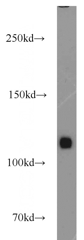 mouse heart tissue were subjected to SDS PAGE followed by western blot with Catalog No:112460(MAML1 antibody) at dilution of 1:1000