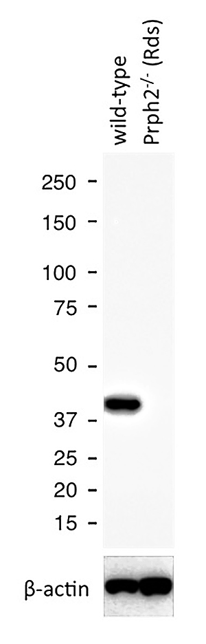 WB results of GNAT1 antibody (Catalog No:110993) with WT mouse Eye and Prph2 (Rds) mutant mouse Eye (Negative control). Courtesy of Seongjin Seo, PhD, University of Iowa College of Medicine.