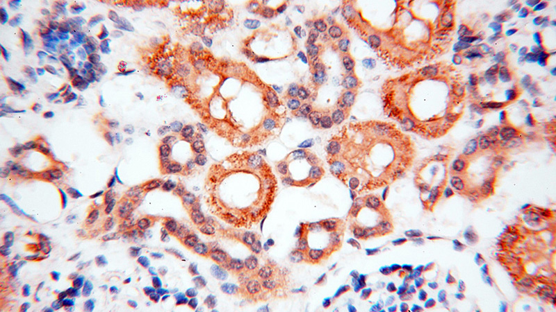 Immunohistochemical of paraffin-embedded human kidney using Catalog No:108569(BPHL antibody) at dilution of 1:100 (under 40x lens)