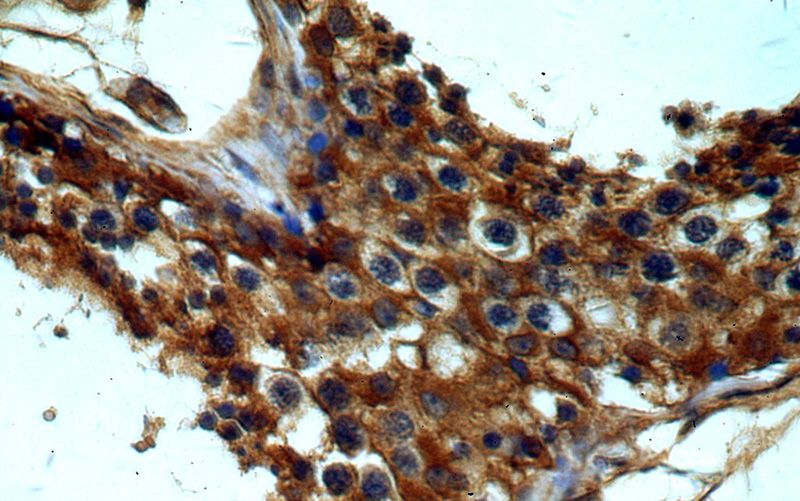 Immunohistochemical of paraffin-embedded human testis using Catalog No:111011(GNRHR antibody) at dilution of 1:50 (under 40x lens)