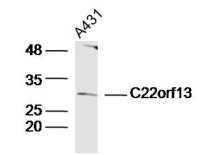 Fig1: Sample:; A431 Cell(Human)Lysate at 30 ug; Primary: Anti- C22orf13 at 1/300 dilution; Secondary: IRDye800CW Goat Anti-Rabbit IgG at 1/20000 dilution; Predicted band size: 27kD; Observed band size: 27kD