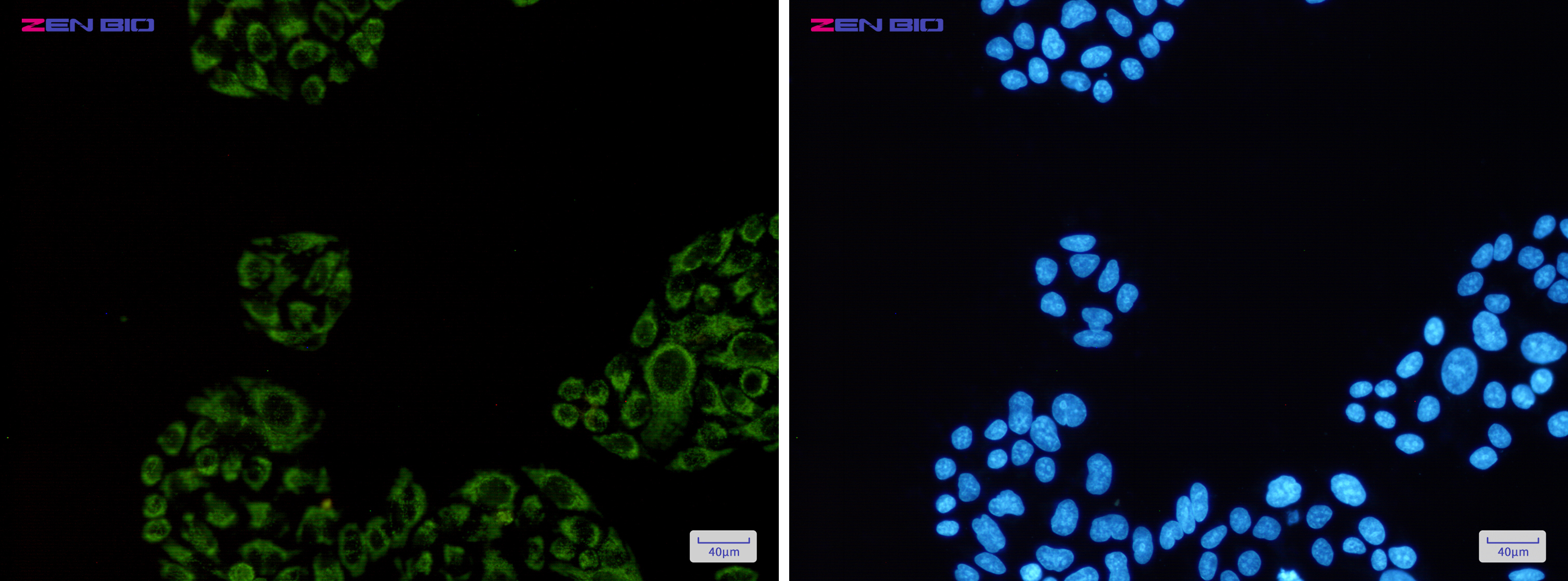 Immunocytochemistry of SDHA(green) in Hela cells using SDHA Rabbit pAb at dilution 1/50, and DAPI(blue)