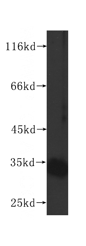 Jurkat cells were subjected to SDS PAGE followed by western blot with Catalog No:107310(GSTO1 antibody) at dilution of 1:400