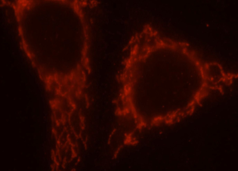 Immunofluorescent analysis of HepG2 cells, using SAMD4B antibody Catalog No:115053 at 1:25 dilution and Rhodamine-labeled goat anti-rabbit IgG (red).