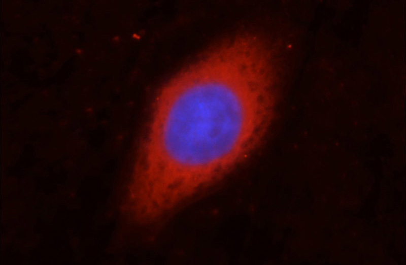Immunofluorescent analysis of HepG2 cells, using GAPDH antibody Catalog No:117317 at 1:50 dilution and Rhodamine-labeled goat anti-rabbit IgG (red). Blue pseudocolor = DAPI (fluorescent DNA dye).