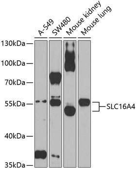 Western blot - SLC16A4 Polyclonal Antibody 