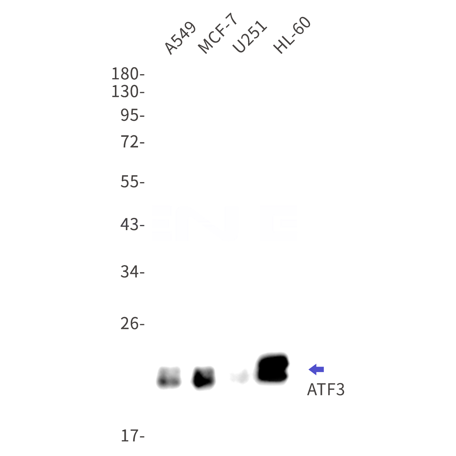 Western blot detection of ATF3 in A549,MCF-7,U251,HL-60 cell lysates using ATF3 Rabbit mAb(1:1000 diluted).Predicted band size:21kDa.Observed band size:21kDa.