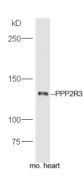 Fig2: Sample: Heart (Mouse) Lysate at 40 ug; Primary: Anti-PPP2R3 at 1/300 dilution; Secondary: HRP conjugated Goat-Anti-rabbit IgG (bs-0295G-HRP) at 1/5000 dilution; Predicted band size: 130 kD; Observed band size: 130 kD