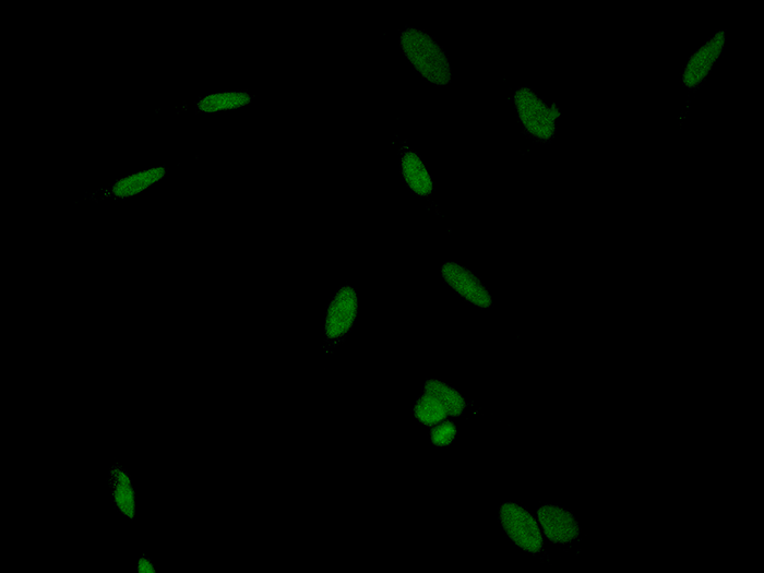PARP-1 / PARP Antibody, Rabbit PAb, Antigen Affinity Purified, Immunofluorescence