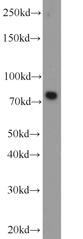 mouse brain tissue were subjected to SDS PAGE followed by western blot with Catalog No:113124(NCDN antibody) at dilution of 1:1000