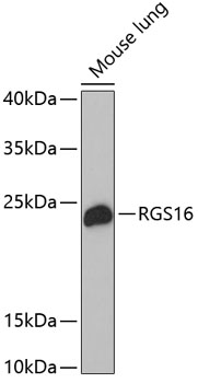 Western blot - RGS16 Polyclonal Antibody 