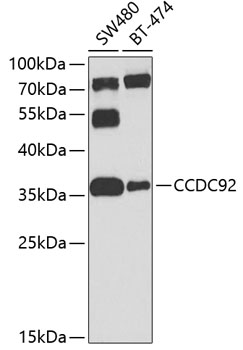 Western blot - CCDC92 Polyclonal Antibody 