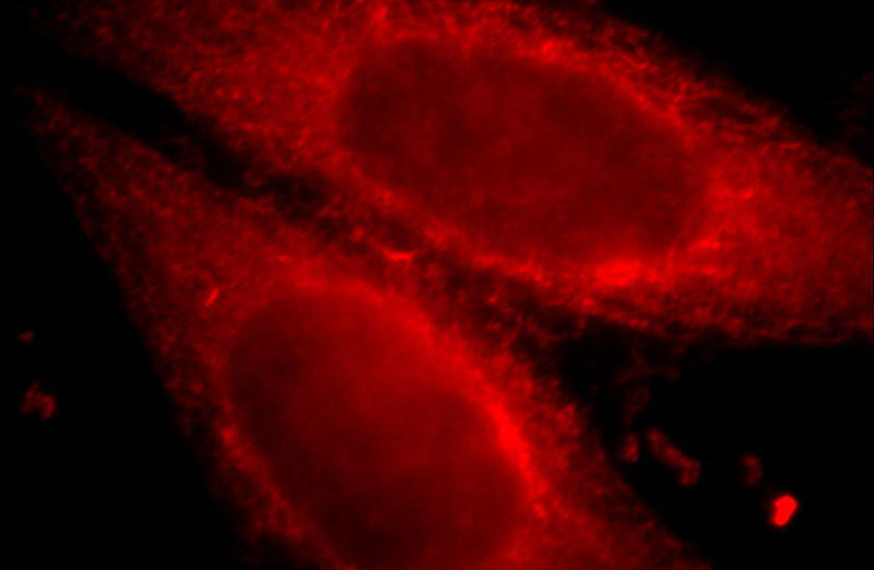 Immunofluorescent analysis of HepG2 cells, using IL8RB antibody Catalog No:109643 at 1:25 dilution and Rhodamine-labeled goat anti-rabbit IgG (red).
