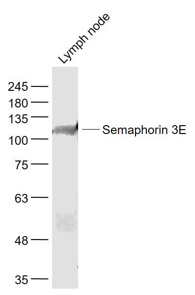 Fig2: Sample:; Lymph node (Mouse) Lysate at 40 ug; Primary: Anti- Semaphorin 3E at 1/1000 dilution; Secondary: IRDye800CW Goat Anti-Rabbit IgG at 1/20000 dilution; Predicted band size: 86 kD; Observed band size: 111 kD