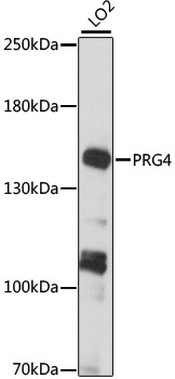 Western blot - PRG4 Polyclonal Antibody 