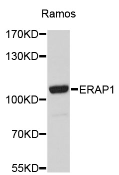 Western blot - ERAP1 Polyclonal Antibody 