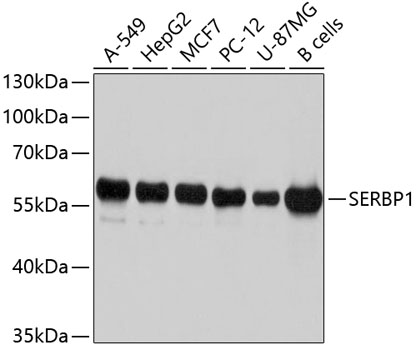 Western blot - SERBP1 Polyclonal Antibody 
