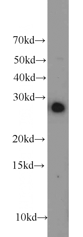 HT-1080 cells were subjected to SDS PAGE followed by western blot with Catalog No:113805(EGLN3 antibody) at dilution of 1:1000
