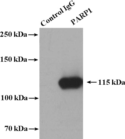 IP Result of anti-PARP1 (IP:Catalog No:113587, 4ug; Detection:Catalog No:113587 1:1000) with K-562 cells lysate 3200ug.