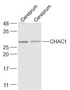Fig2: Sample:; Cerebrum (Mouse) Lysate at 40 ug; Cerebrum (Rat) Lysate at 40 ug; Primary: Anti-CHAC1 at 1/1000 dilution; Secondary: IRDye800CW Goat Anti-Rabbit IgG at 1/20000 dilution; Predicted band size: 29 kD; Observed band size: 29 kD