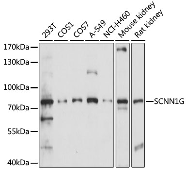 Western blot - SCNN1G Polyclonal Antibody 