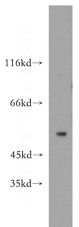 SH-SY5Y cells were subjected to SDS PAGE followed by western blot with Catalog No:111114(GPR142 antibody) at dilution of 1:300