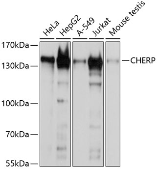 Western blot - CHERP Polyclonal Antibody 