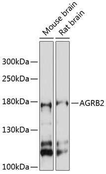 Western blot - AGRB2 Polyclonal Antibody 