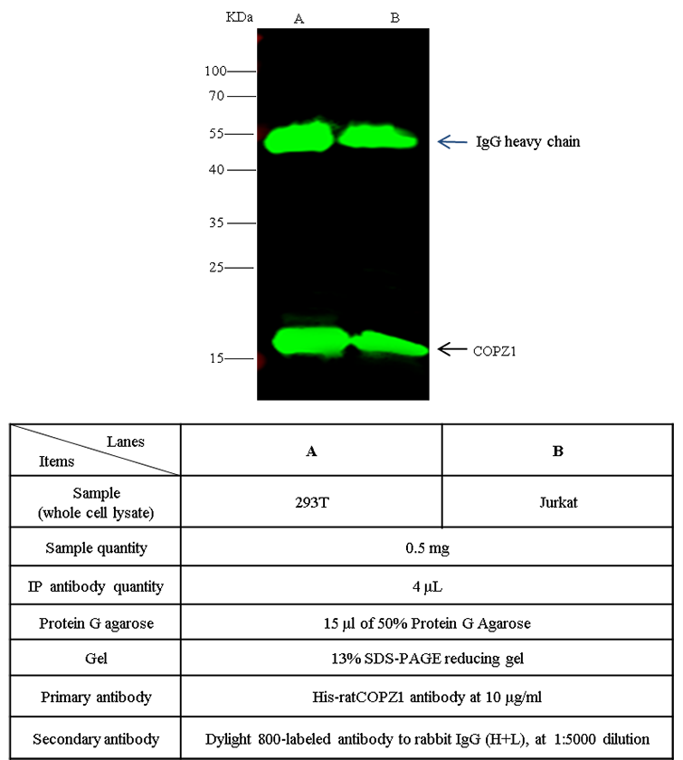 COPZ1 / Zeta-1 COP Antibody, Rabbit PAb, Antigen Affinity Purified, Immunoprecipitation