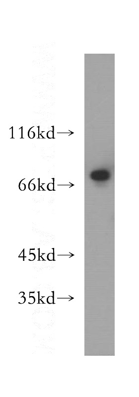 A375 cells were subjected to SDS PAGE followed by western blot with Catalog No:113366(NUFIP1 antibody) at dilution of 1:400