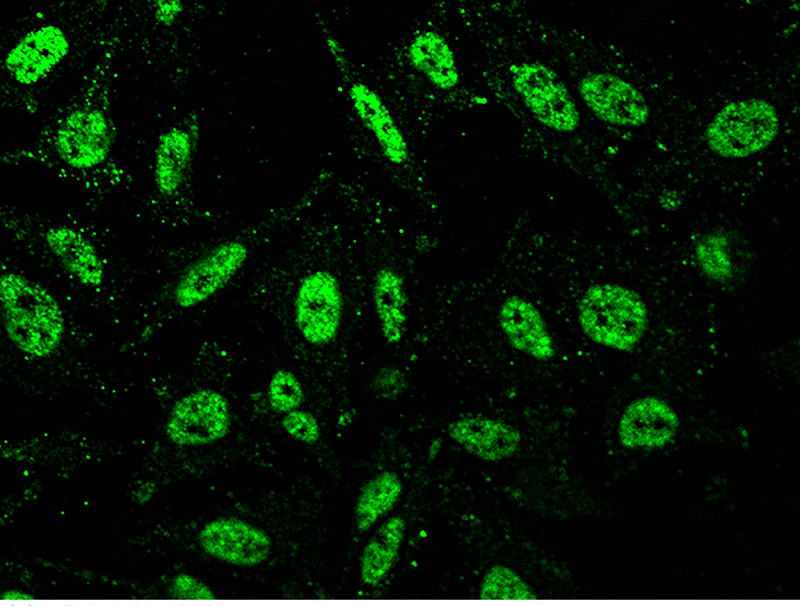 Human HIF1AN Immunofluorescence(IF) 14862