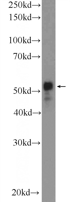 A431 cells were subjected to SDS PAGE followed by western blot with Catalog No:108695(C20orf160 Antibody) at dilution of 1:300