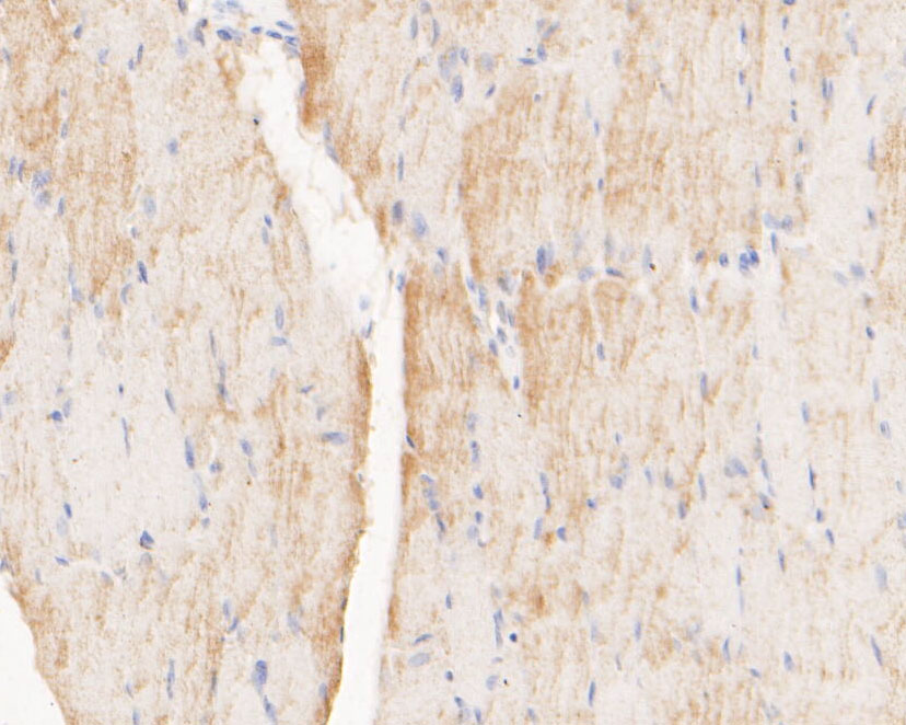 Fig2:; Immunohistochemical analysis of paraffin-embedded rat skeletal muscle tissue using anti-Myomegalin antibody. The section was pre-treated using heat mediated antigen retrieval with Tris-EDTA buffer (pH 8.0-8.4) for 20 minutes.The tissues were blocked in 5% BSA for 30 minutes at room temperature, washed with ddH; 2; O and PBS, and then probed with the primary antibody ( 1/200) for 30 minutes at room temperature. The detection was performed using an HRP conjugated compact polymer system. DAB was used as the chromogen. Tissues were counterstained with hematoxylin and mounted with DPX.