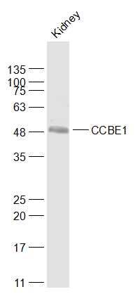 Fig1: Sample:; Kidney (Mouse) Lysate at 40 ug; Primary: Anti-CCBE1 at 1/1000 dilution; Secondary: IRDye800CW Goat Anti-Rabbit IgG at 1/20000 dilution; Predicted band size: 41 kD; Observed band size: 49 kD