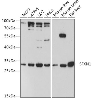 Western blot - SFXN1 Polyclonal Antibody 