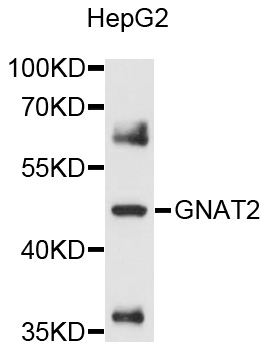 Western blot - GNAT2 Polyclonal Antibody 