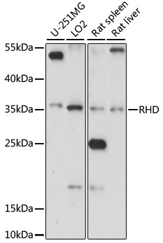 Western blot - RHD Polyclonal Antibody 