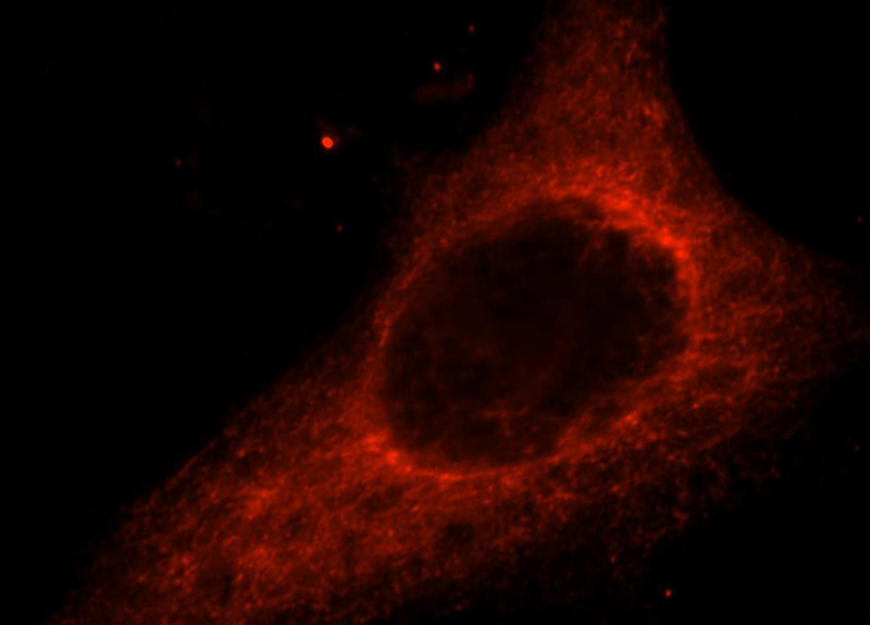 Immunofluorescent analysis of Hela cells, using ACAD10 antibody Catalog No:107825 at 1:25 dilution and Rhodamine-labeled goat anti-rabbit IgG (red).