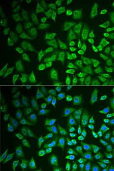 Immunofluorescence - DDX41 Polyclonal Antibody 
