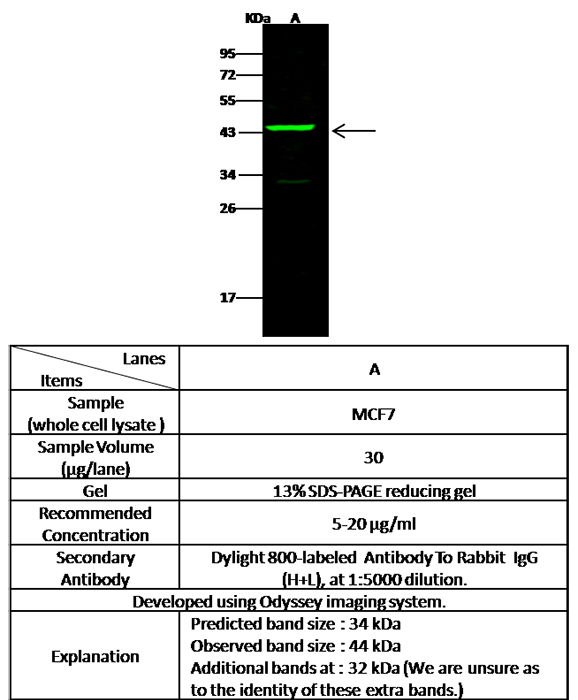 Human Alpha-2-glycoprotein / AZGP1 Western blot (WB) 15239