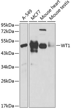 Western blot - WT1 Polyclonal Antibody 